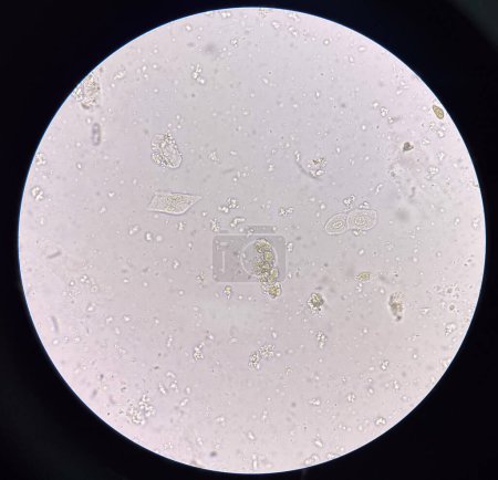 Téléchargez les photos : Planche Moulée dans de l'urine fraîche découverte au microscope. - en image libre de droit