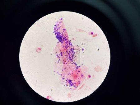 Photo for Bacteria in Gram stain Gram positive bacilli. - Royalty Free Image