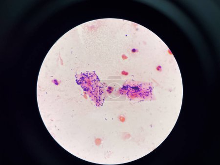 Foto de Bacterias en la tinción de Gram Bacilos Gram positivos. - Imagen libre de derechos