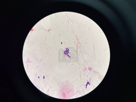 Yeast cell in gram stain.