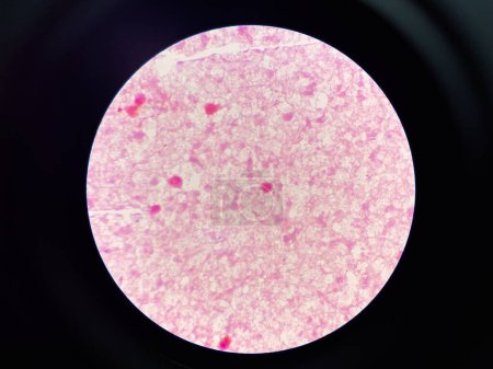 red bacteria cell branching in hemoculture test.