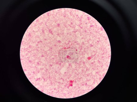 red bacteria cell branching in hemoculture test.