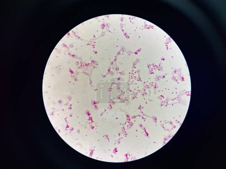 Bakterienzellen gram neagtive Bakterien cococobacilli.