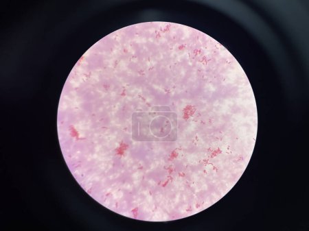 Moderate bacteria cell gram negtive bacilli in hemoculture.