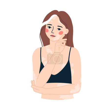 Illustration for Vector illustration portrait of a beautiful girl with vitiligo. The concept of accepting yourself and your body. Body positivity. - Royalty Free Image