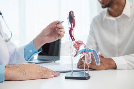 Doctors are counseling prostate cancer patients and using model of the penis to provide an example for prostate cancer patients about future symptoms and treatments. Prostate cancer treatment concepts