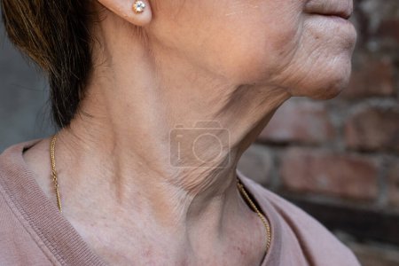 Photo for Aging skin folds or skin creases or wrinkles at neck of Southeast Asian, Chinese old woman. - Royalty Free Image