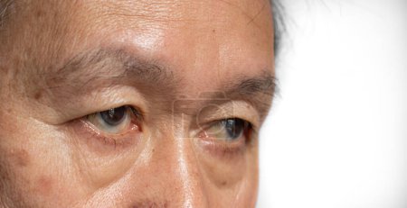 Foto de La piel se pliega alrededor del ojo del anciano asiático que muestra el envejecimiento. - Imagen libre de derechos