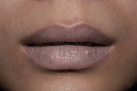 Photo for Pale lips of Asian woman patient. Sign of anemia. Closeup view. - Royalty Free Image