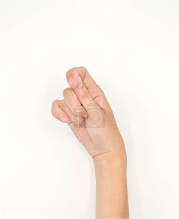 Téléchargez les photos : Cerebral palsy hand in Southeast Asian young male patient. Typically seen in hemiplegia and quadriplegia. Wrist joint flexion with ulnar deviation - en image libre de droit