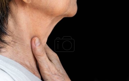 Pain at the neck of Asian, Myanmar woman. Concept of sore throat, pharyngitis, laryngitis, esophagitis, thyroiditis, or dysphagia.