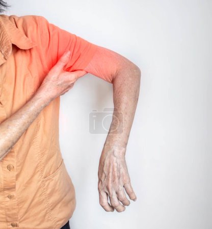 Photo for Pain in the shoulder joint and arm of Southeast Asian old woman. Concept of frozen shoulder. - Royalty Free Image