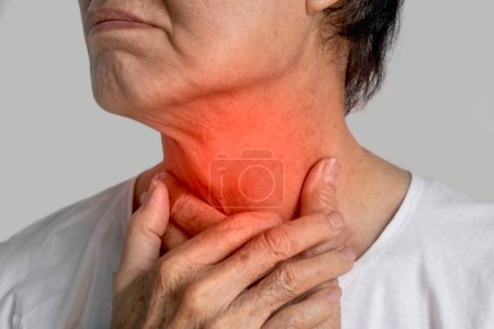 Rötung am Hals des asiatischen Mannes. Konzept von Halsschmerzen, Rachenentzündung, Kehlkopfentzündung, Ösophagitis, Thyrotoxikose, Thyreoiditis, Würgen oder Dysphagie.
