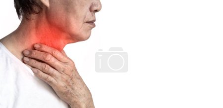 Photo for Redness at the neck of Asian man. Concept of sore throat, pharyngitis, laryngitis, esophagitis, thyroiditis, thyrotoxicosis, choking or dysphagia. - Royalty Free Image