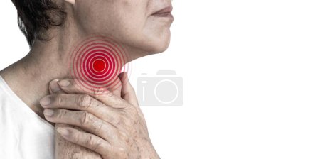Photo for Redness at the neck of Asian man. Concept of sore throat, pharyngitis, laryngitis, esophagitis, thyroiditis, choking or dysphagia. - Royalty Free Image