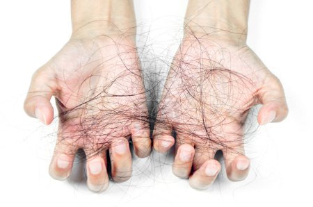 Téléchargez les photos : Problème de perte de cheveux sur les mains féminines isolées sur fond blanc. - en image libre de droit