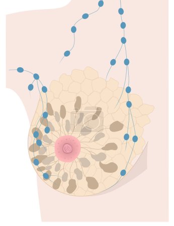 Illustration for Internal structure of woman breast and lymph nodes realistic drawing. Part of breast of light skin female with mammary glands, nipple, areola and Montgomerys glands represented. Vector illustration - Royalty Free Image