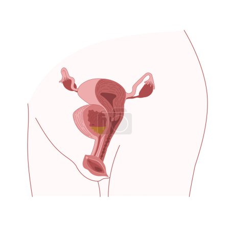 Téléchargez les illustrations : L'utérus humain et la vessie montrés sur le corps de la femme. Vulve avec urètre et clitoris. Illustration vectorielle - en licence libre de droit