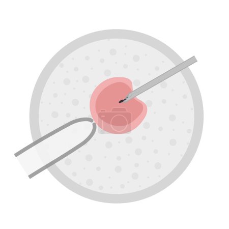 Hand drawn image of in vitro human artificial fertilization in petri dish with tube and needle. Vector illustration
