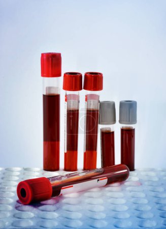 Photo for Tubes blood sample in rack.(blue tone - Royalty Free Image