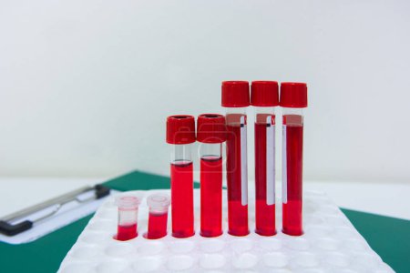 Photo for Tubes blood sample in rack. - Royalty Free Image