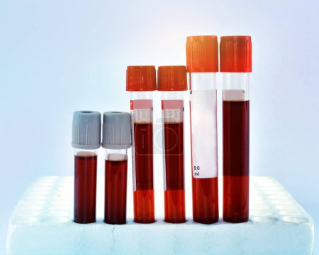 Photo for Tubes blood sample in rack.(blue tone) - Royalty Free Image
