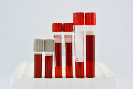 Photo for Tubes blood sample in rack - Royalty Free Image