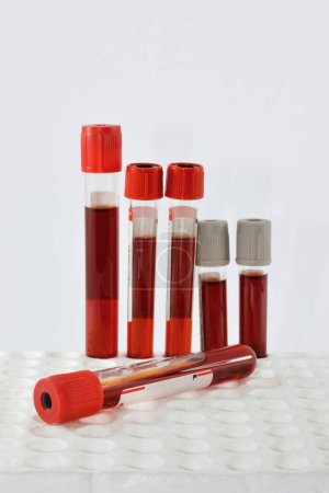 Photo for Tubes blood sample in rack - Royalty Free Image
