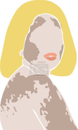 Téléchargez les illustrations : Illustration vectorielle d'une belle femme vitiligo à demi tour, peau unique, concept de beauté naturelle - en licence libre de droit