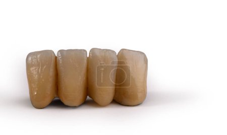 Téléchargez les photos : Le sourire parfait : améliorer l'esthétique dentaire avec les couronnes - en image libre de droit