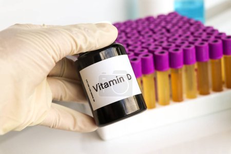 Téléchargez les photos : Pilules de vitamine D dans une bouteille, complément alimentaire pour la santé ou utilisé pour traiter la maladie - en image libre de droit