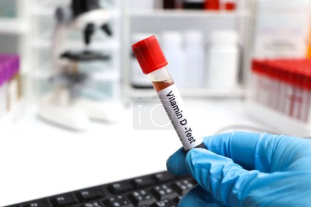 Photo for Blood samples for testing vitamin D in the laboratory, blood sample in test tube - Royalty Free Image