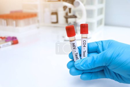 HIV test and CD4 test to look for abnormalities from blood,  blood sample to analyze in the laboratory, blood in test tube