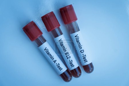 Téléchargez les photos : Échantillons de sang pour analyse de vitamine en laboratoire, échantillon de sang dans une éprouvette - en image libre de droit