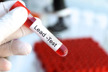 Photo for Lead test to look for abnormalities from blood,  blood sample to analyze in the laboratory, blood in test tube - Royalty Free Image