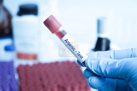 Téléchargez les photos : Test d'arsenic pour rechercher des anomalies du sang, échantillon de sang à analyser en laboratoire, sang dans une éprouvette - en image libre de droit