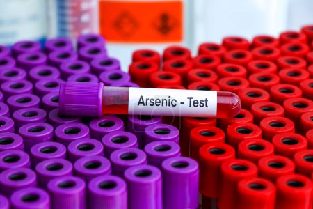 Téléchargez les photos : Test d'arsenic pour rechercher des anomalies du sang, échantillon de sang à analyser en laboratoire, sang dans une éprouvette - en image libre de droit