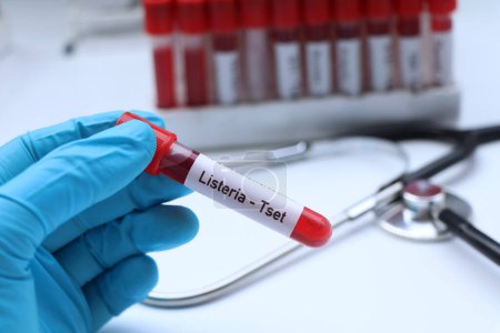 Listerien-Test auf Auffälligkeiten im Blut, Blutprobe zur Analyse im Labor, Blut im Reagenzglas
