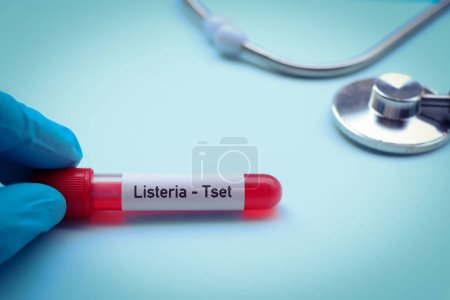 Test de Listeria pour rechercher des anomalies du sang, échantillon de sang à analyser en laboratoire, sang dans une éprouvette