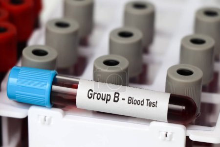 Groupe B - Test sanguin, échantillon de sang à analyser en laboratoire, sang dans une éprouvette