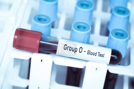 Grupo 0 Análisis de sangre, muestra de sangre para analizar en el laboratorio, sangre en el tubo de ensayo