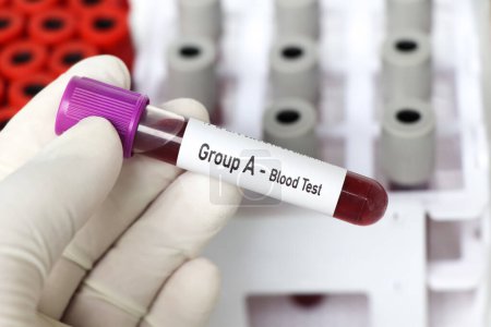 Téléchargez les photos : Groupe A- Test sanguin, échantillon de sang à analyser en laboratoire, sang dans une éprouvette - en image libre de droit