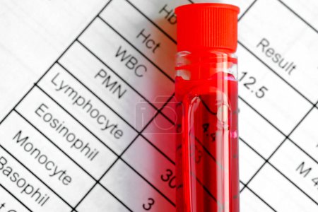 Vollständige Blutproben und Ergebnisse von Bluttests. Gesundheits- und medizinische Konzepte