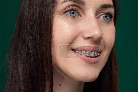 Une femme avec des orthèses sur les dents souriant joyeusement, affichant son traitement orthodontique. Ses dents sont nettement plus droites et alignées, ce qui démontre l'efficacité des appareils pour améliorer les soins dentaires.