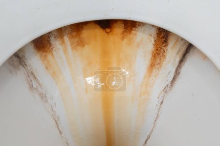 This close-up showcases a white toilet bowl marred by rust patches, highlighting neglect and poor maintenance in a bathroom setting.