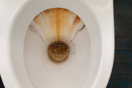 This close-up view depicts a toilet bowl containing a brown substance. The focus is on the unsanitary condition of the toilet and the need for cleaning.
