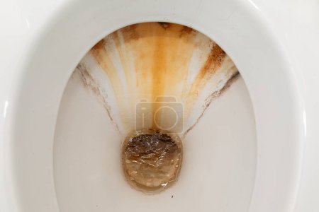 Eine weiße Toilettenschüssel ist mit einer braunen Substanz im Inneren dargestellt, die auf mögliche Fäkalien oder andere Abfälle hinweist. Die Toilette erscheint unsauber und reinigungsbedürftig.
