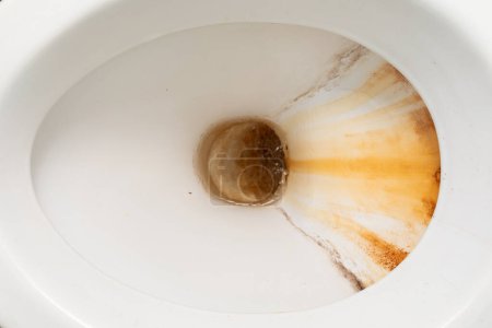 A white toilet bowl is shown with a brown substance inside. The image captures an unclean toilet that requires cleaning to maintain hygiene and cleanliness.