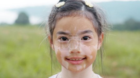 Photo for Little cute alpha young albino vitiligo small school girl relax smile look at camera. Real melanin face body skin care hair color of asia people gen z kid in self love happy proud of diverse beauty. - Royalty Free Image