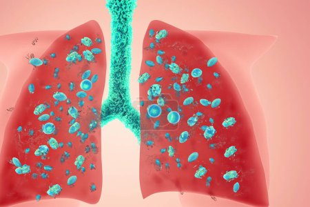 Lungs. Pertussis. Whooping cough. Bordetella pertussis. Lungs with bacteria. Design of lungs with bacteria inside the lungs representing a lung disease.